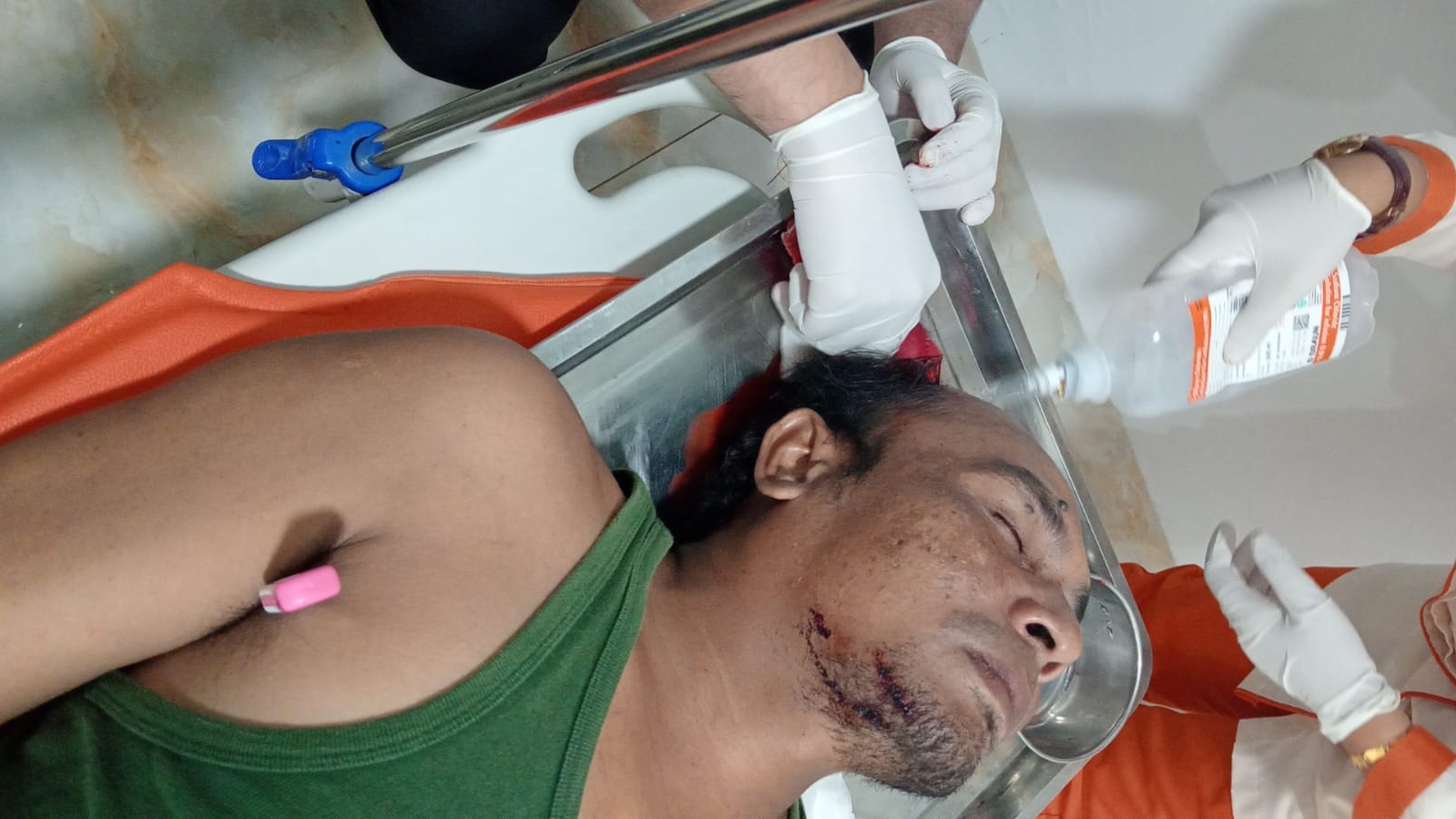 Enam Bulan Pembacok Wartawan di Langkat Belum Ditangkap, Pelaku Terus Ancam Korban & Keluarganya