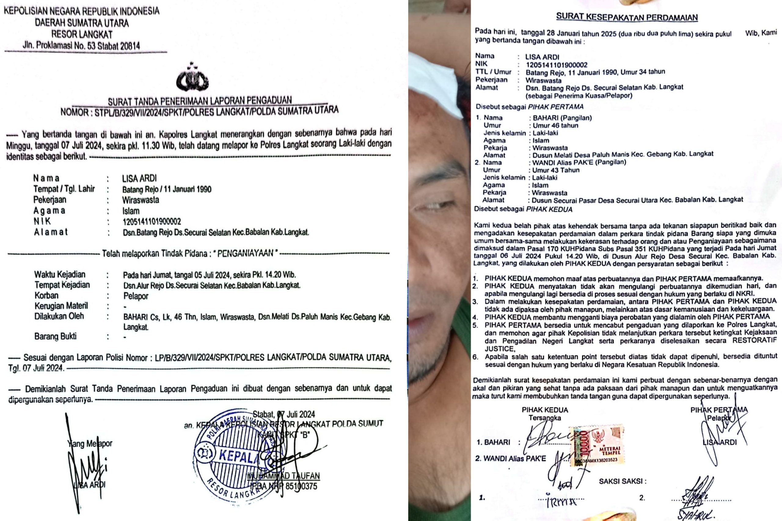 Perdamaian Tak Hentikan Kasus, Pembacok Lisa Ardi Wajib Ditangkap, Ini Alasannya